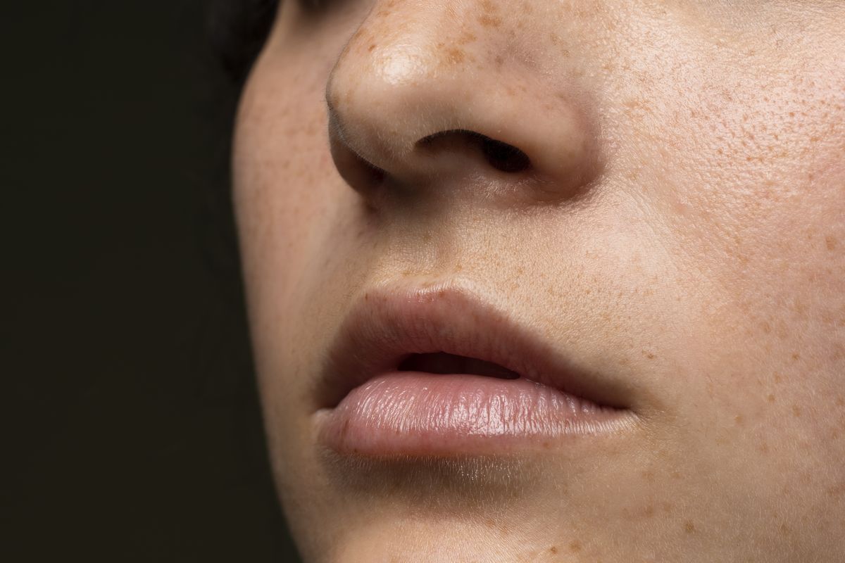 Manchas solares en la cara por qué aparecen y cómo prevenirlas Manchas solares en la cara por qué aparecen y cómo prevenirlas